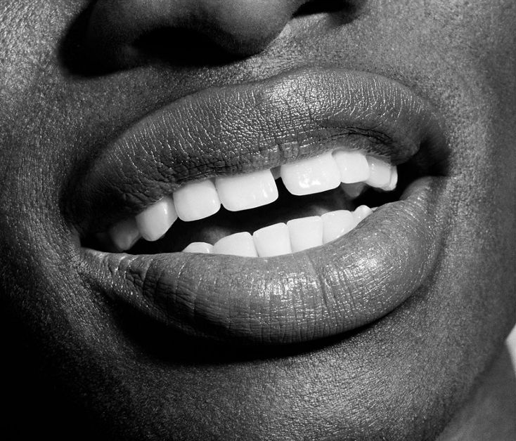 A smiling face showing white teeth.